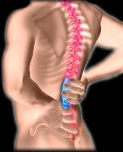Multiple Sclerosis (MS) and Back Pain