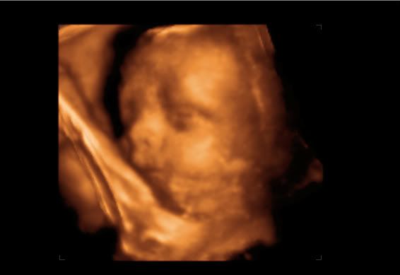 3d ultrasound 20 weeks pregnant. 29+weeks+pregnant+3d+