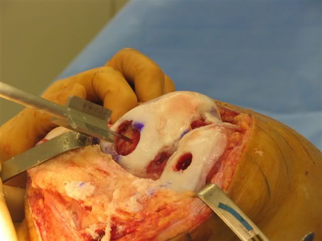 IPB Image