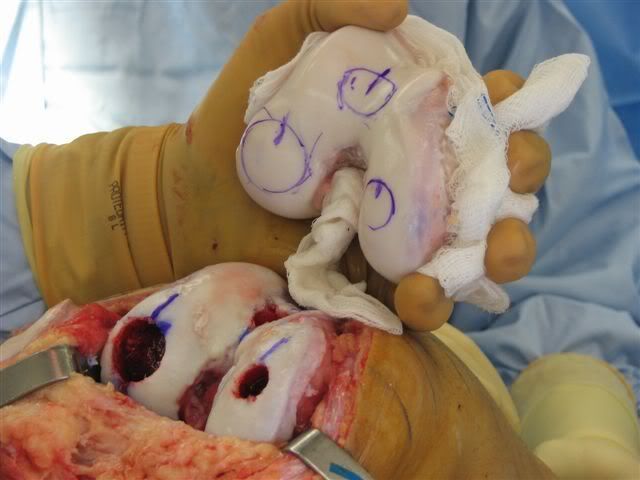IPB Image