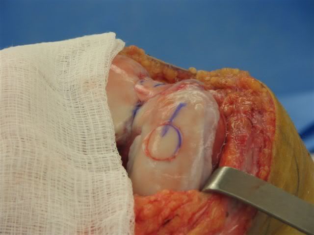 IPB Image