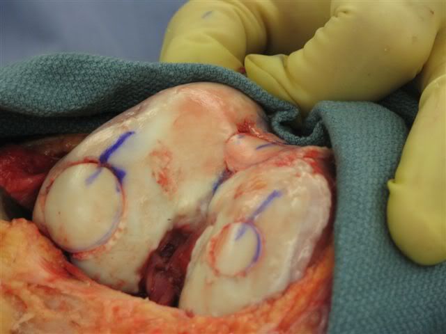 IPB Image